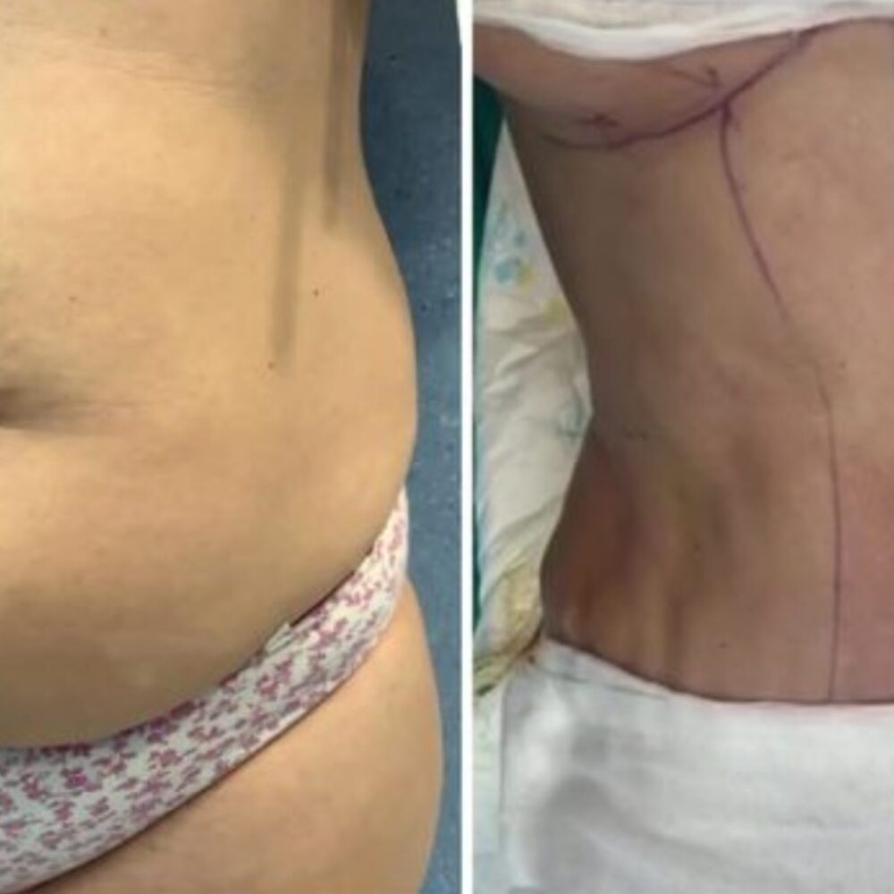 Pourquoi ne pas négliger les soins post-opératoires